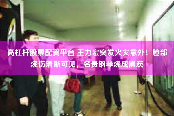 高杠杆股票配资平台 王力宏突发火灾意外！脸部烧伤清晰可见，名贵钢琴烧成黑炭